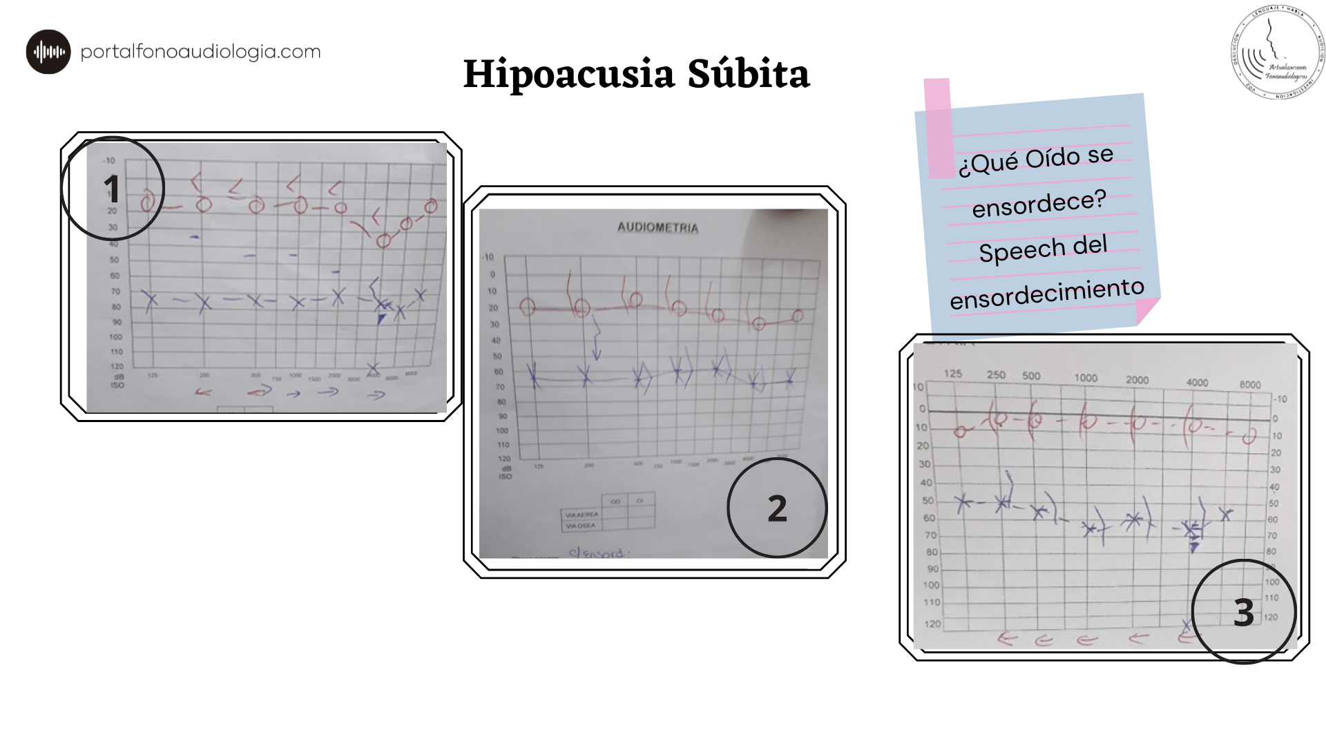 Curso Audiología Clínica