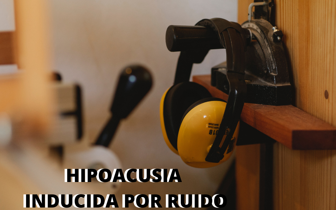 hipoacusia inducida por ruido